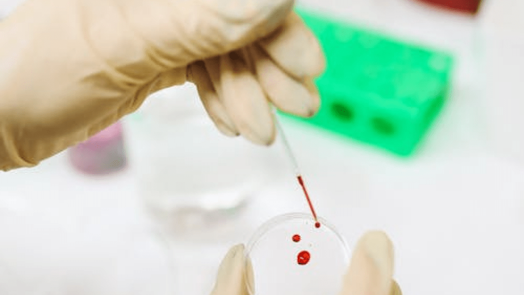 Gesundheitsmessungen jetzt in Ihrer Stadtapotheke!