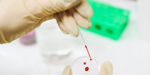 bild-messung tropfen