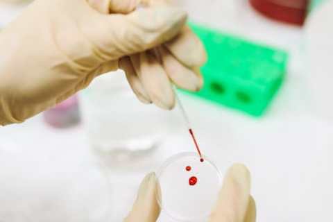 bild-messung tropfen